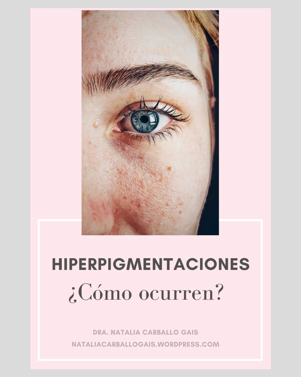 Hiperpigmentación de la piel… ¿Cómo ocurre?